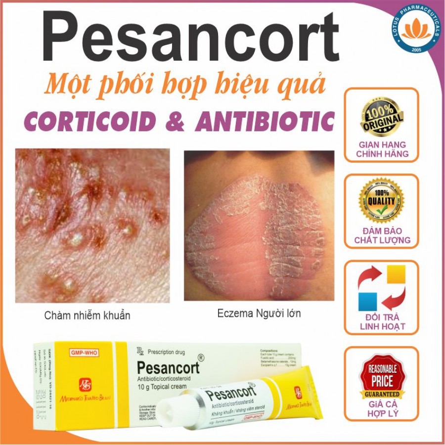 Pesancort Cream 15g